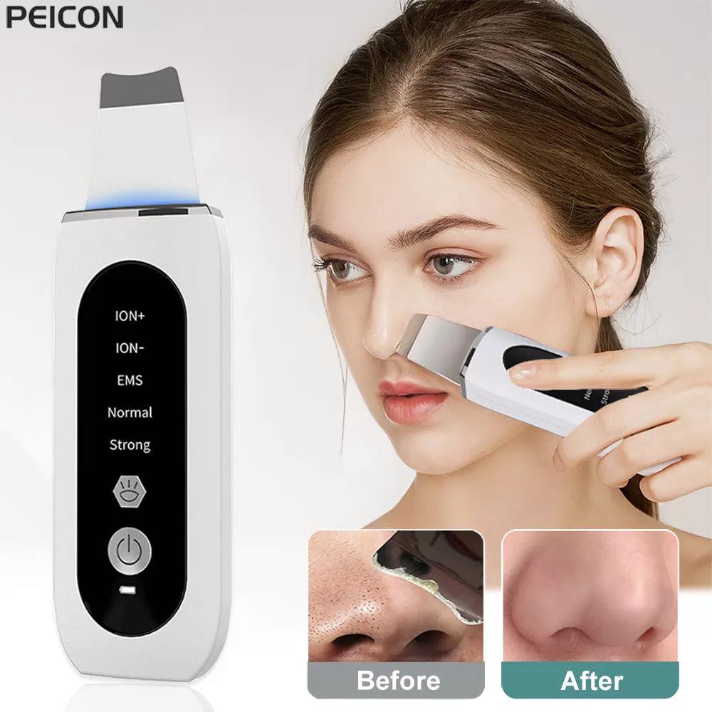 Ultrasonic Skin Scrubber Blackhead Remover Deep Face Cleanser