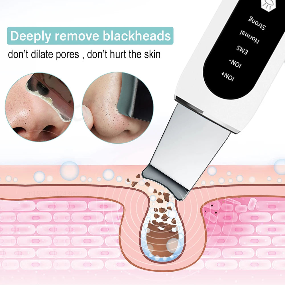 Ultrasonic Skin Scrubber Blackhead Remover Deep Face Cleanser