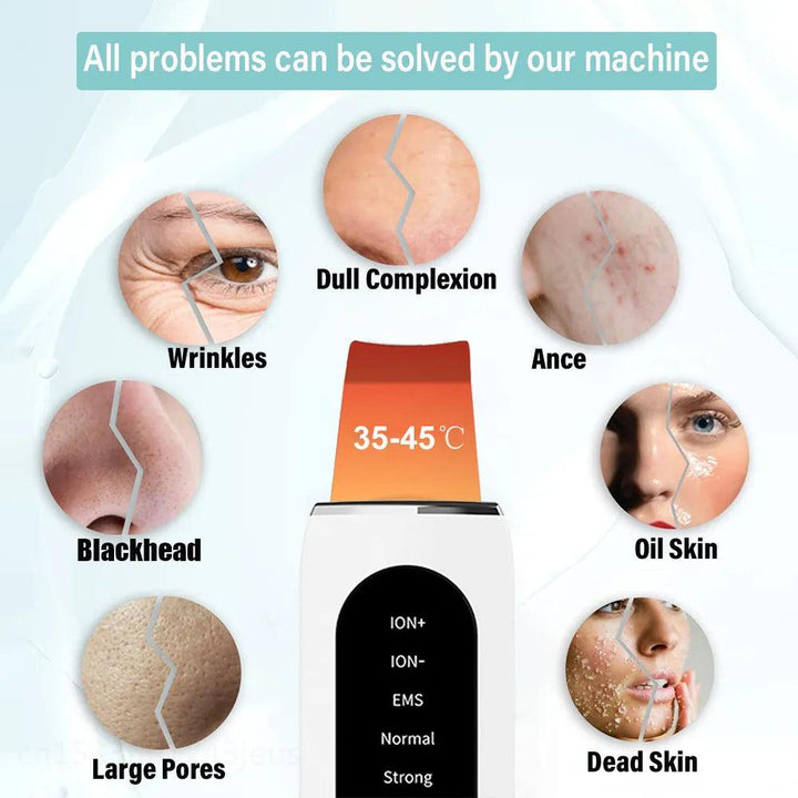 Ultrasonic Skin Scrubber Blackhead Remover Deep Face Cleanser