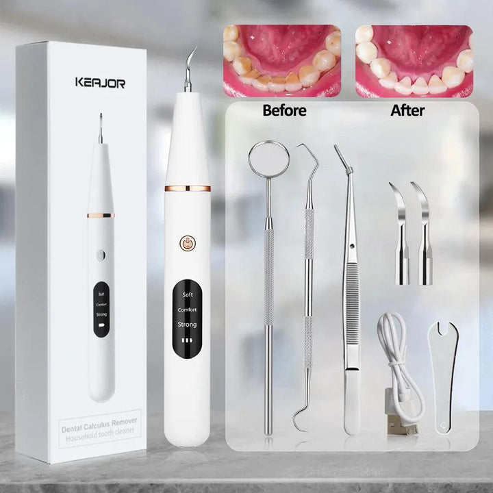 Image of the Electrical Tartar, Plaque & Dental Calculus Remover kit by Kerjoi, showcasing an ultrasonic device with settings display and five metal dental tools. A "Before" and "After" photo illustrates teeth transformation, with the packaging prominently displaying the brand name.